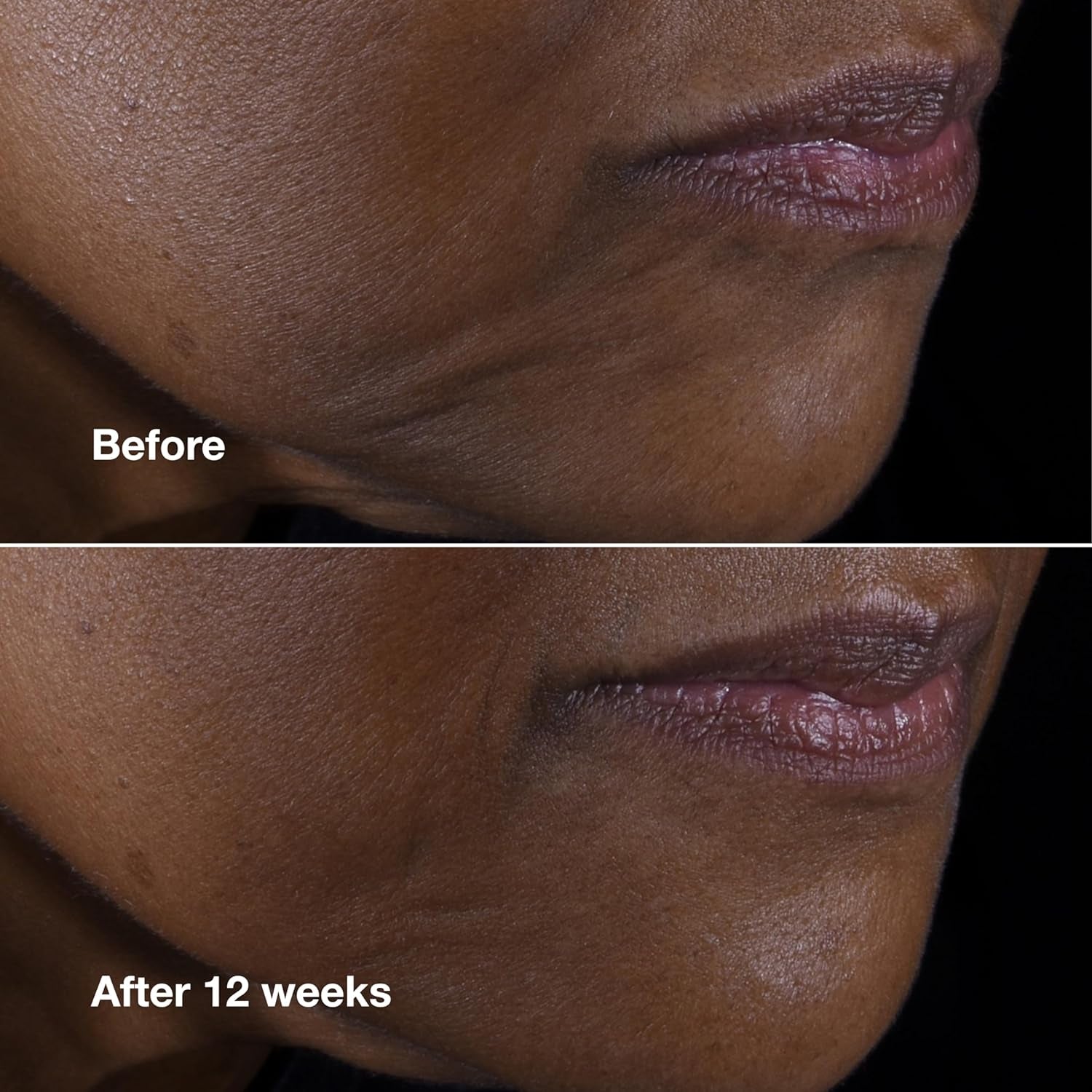 Clinique Smart Clinical Repair Lifting Face + Neck Cream